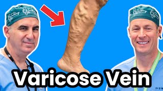 Varicose Vein Injections Watch A Vascular Surgeon Do It [upl. by Arriaet]