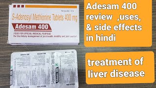 Adesam 400 review uses ampside effects [upl. by Pepillo813]