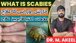 Defeating Scabies  what is scabies precautions and treatment  Kharish Ka ilaj in Urdu [upl. by Akirehs]