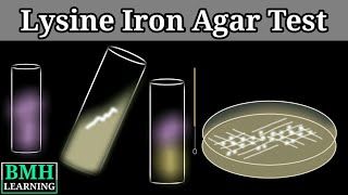 Lysine Iron Agar Test  Lysine Decarboxylase Test [upl. by Kcirdderf]