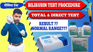 Total amp Direct Bilirubin test procedure practical video पीलिया टेस्टjaundice testserum bilirubin [upl. by Manara]