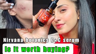 Nirvana botanics Vitamin CE serum  Masooma B [upl. by Rich]