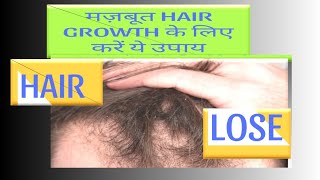 Minoxidil Finasteride topical solution hair growth results Hair regrowth diet [upl. by Reld]