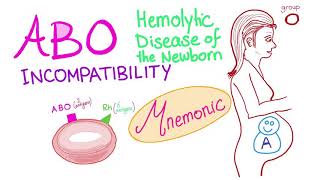 ABO incompatibility mnemonic [upl. by Nesta]