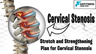 Complete Cervical Stenosis Exercises and Stretch Plan For Pain Management and Postural Correction [upl. by Cusack]