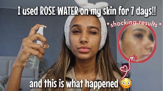 Unexpected reaction after I used ROSE WATER on my face for a week [upl. by Craner]