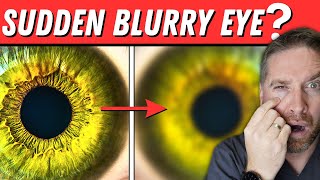 Sudden Blurry Vision In One Eye 5 Causes [upl. by Moises150]