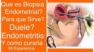 BIOPSIA ENDOMERIAL ENDOMETRITIS MI EXPERIENCIA [upl. by Madelena]