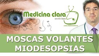 Moscas volantes ó Miodesopsias  Problemas de visión [upl. by Redvers703]