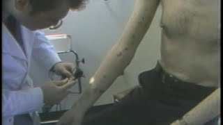 1983 REPORT Diagnosis  EARLY AIDS DOCUMENTARY [upl. by Crutcher]