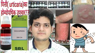 Urticaria Homeopathic medicine for Urticaria explain [upl. by Adnaw990]