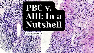 Primary Biliary Cholangitis v Autoimmune Hepatitis In a Nutshell pathagonia [upl. by Kuehn]