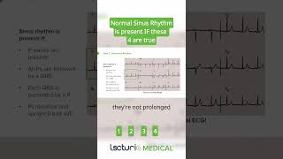 How to Identify Normal Sinus Rhythm [upl. by Noyr]