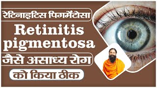 रेटिनाइटिस पिगमेंटोसा Retinitis pigmentosa जैसे असाध्य रोग को किया ठीक  Swami Ramdev [upl. by Grefer]