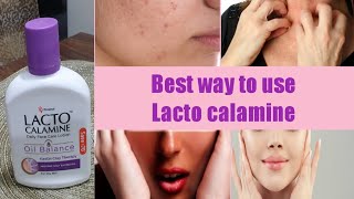 Lecto Calamine Lotion UsesBest 5 Way to Use On SkinNo More Dry pigmentedItcy Skin [upl. by Nic589]