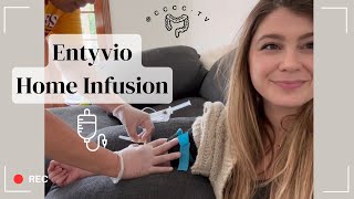 Home Infusion of Entyvio for Ulcerative Colitis [upl. by Leahcimsemaj]