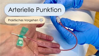 Arterielle Punktion  Schritt für Schritt Allen Test arterielle BGA Aradialis Tipps und Tricks [upl. by Sancha923]