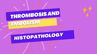 Thrombosis and Embolism Pathology  Ample Medical Lectures [upl. by Nahpets]