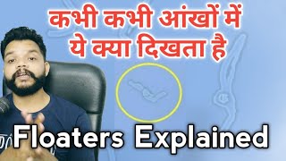 Floaters In Eyes Explained  Eye Floaters Risk amp Treatment In Hindi  Gyanear [upl. by Merkley]