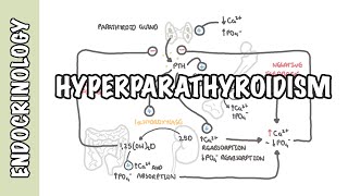 Hyperparathyroidism and the different types causes pathophysiology treatment [upl. by Kunkle]