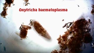 Oxytricha haematoplasma [upl. by Kotta]