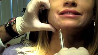 Cannula Method for Fillers  Dr Nissan Pilest Irvine CA [upl. by Mecke]