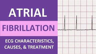 Atrial Fibrillation AFib ECG Treatment Causes Nursing NCLEX Review ACLS [upl. by Nahtal]