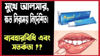 মুখের আলসার দূর করে যে মেডিসিন Apsol oral pest Review bangla  Apthous Ulcer Treatment Bangla [upl. by Sisxela]