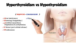 hyperthyroidism vs hypothyroidism [upl. by Htebilil694]