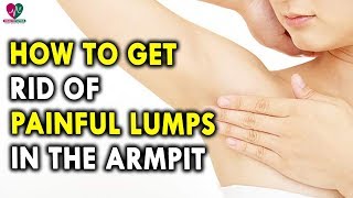 How To Get Rid Of Painful Lumps In The Armpit  Health Sutra [upl. by Hildagard]