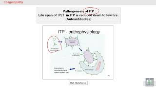 Pathology Hematology  44  Thrombocytopenia Platelets destruction [upl. by Darill]