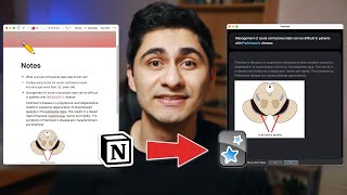 INSTANTLY Turn Your Notion Notes Into Anki Flashcards [upl. by Norahc243]