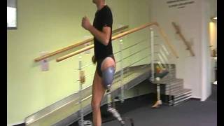 Above knee amputee running on prosthetic leg [upl. by Grieve]