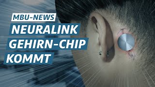 Neuralink startet MenschenExperimente  MBU News [upl. by Shelah]