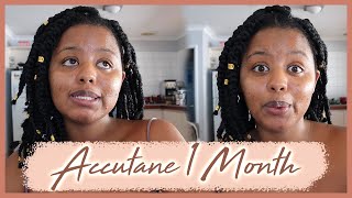 Accutane Journey  1 MONTH Accutane before and after  Roaccutane Mild Acne  Dark skin [upl. by Eelnyl464]