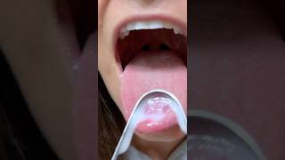 How to Tongue Scrape The Right Way freshbreath [upl. by Schilt]