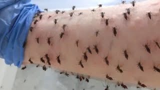 Cómo hacer repelente casero para mosquitos argentina noticias shorts [upl. by Akihsar]