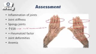 Arthritis NCLEX® Review  NRSNGacademycom [upl. by Haisi959]