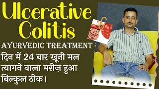 Ulcerative Colitis Ayurvedic Treatment दिन में 24 बार खूनी मल त्यागने वाला मरीज़ हुआ बिल्कुल ठीक। [upl. by Braun817]