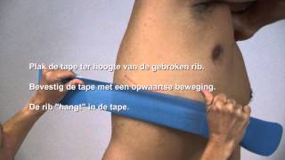 Aanbrengen van tape bij een gebroken rib [upl. by Heigho245]