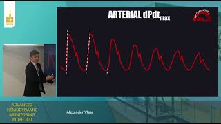 Advanced hemodynamic monitoring in the ICU Alexander Vlaar 2023 [upl. by Iver482]