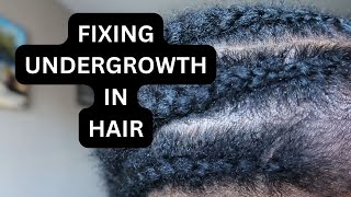 What Causes Undergrowth in Hair and How To Fix It [upl. by Anavoj]