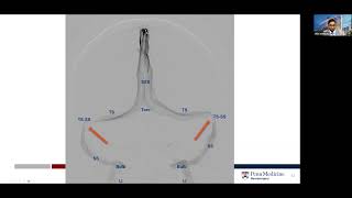 Venous Manometry Explained [upl. by Killigrew]