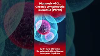 Diagnosis of CLL Chronic Lymphocytic Leukemia Part 2 by DrSurajChiraniyaHematologist leukemia [upl. by Gibb214]