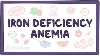 Iron deficiency anemia  an Osmosis Preview [upl. by Aleras]