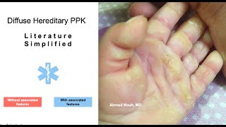 A Clinical approach to Palmoplantar Keratoderma [upl. by Ammeg598]