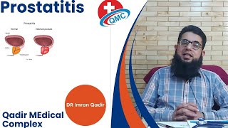 Prostatitis  Dr imran Qadir [upl. by Laughlin]