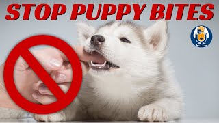 Help How Do I STOP Puppy Biting 17 [upl. by Nyvar136]