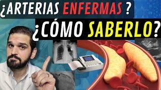 INTERESANTE¡ Exámenes para saber SI TENGO las ARTERIAS del corazón ENFERMAS 😲 [upl. by Sicular]