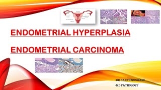 Endometrial Carcinoma amp Endometrial Hyperplasia [upl. by Olenolin390]